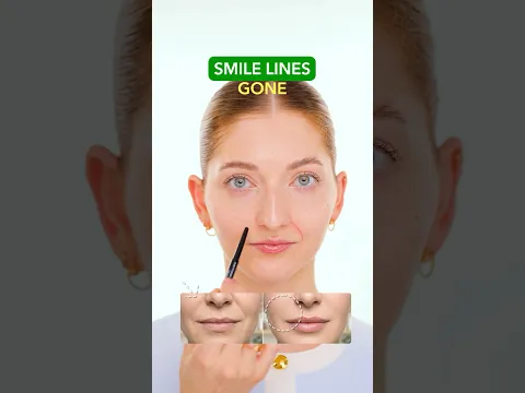 Wrinkles Exercise Face: Smile lines | Face Yoga | Face Fitness | Face Massage