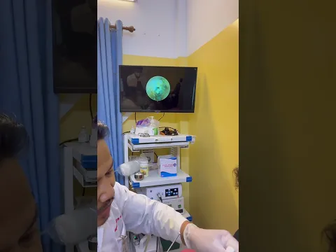 😱 Don’t Blink—This Earwax Extraction Happens Fast! #earwaxremoval #earcare #shorts