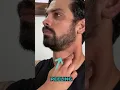 The BEST Self Massage Routine For The Sternocleidomastoid