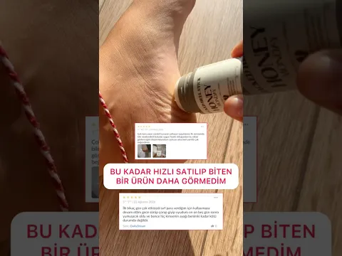 TOPUKLARIN KURTULACAK MUCİZE GİBİ BİR SONUÇ #ciltbakımı #trend