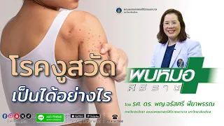 อาการของโรคงูสวัดต่างจากโรคสุขใสอย่างไร 