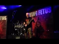 DYING FETUS - Second Skin