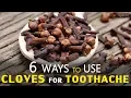 6 Ways to Use Cloves for Toothache