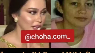 أخت كوثر براني قبل وبعد عملية التجميل 