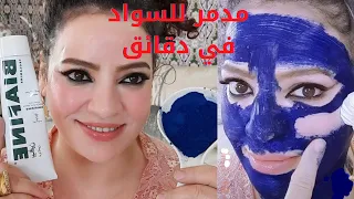 عشرينيه تقسم نصحني بهاطبيب تجميل كان وجهي محروق سواد وإلتهابات وأصبح أبيض كالثلج كل من رأىوجهي تعجب 