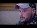 2 years after face transplant Andy Sandness smile shows his progress