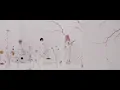 Cö shu Nie – 絶体絶命 (Live) / “約束のネバーランド” ED