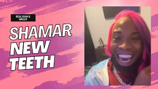 Shamar pops out with New Teeth
