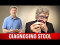 Types of Stool Size Shape Color - Stool Analysis by Dr Berg