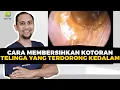 Cara Membersihkan Kotoran Telinga Yang Terdorog Kedalam | Dokter Tht