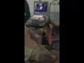 How can you do the complete IVC study very easy and so accurate