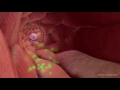Extravasation of Neutrophils