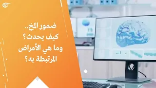 ضمور المخ   كيف يحدث  وما هي الأمراض المرتبطة به  دندنها