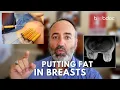 5 Reasons NOT to Inject Fat into Your Breasts - Breast Augmentation with Fat Grafting