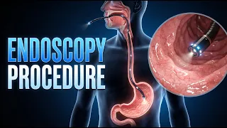 Why Do Doctors Insert a Camera Tube Inside Your Stomach During an Endoscopy?