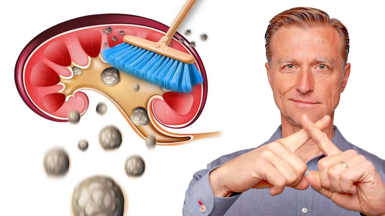 Outline Video Clean Out Your Kidneys of Oxalates and Stones - Dr. Berg