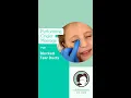 How to Perform the Crigler Massage for Blocked Tear Ducts