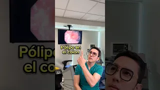 Los polipos en el colon son la principal causa de cáncer de colon. #medicina #shorts