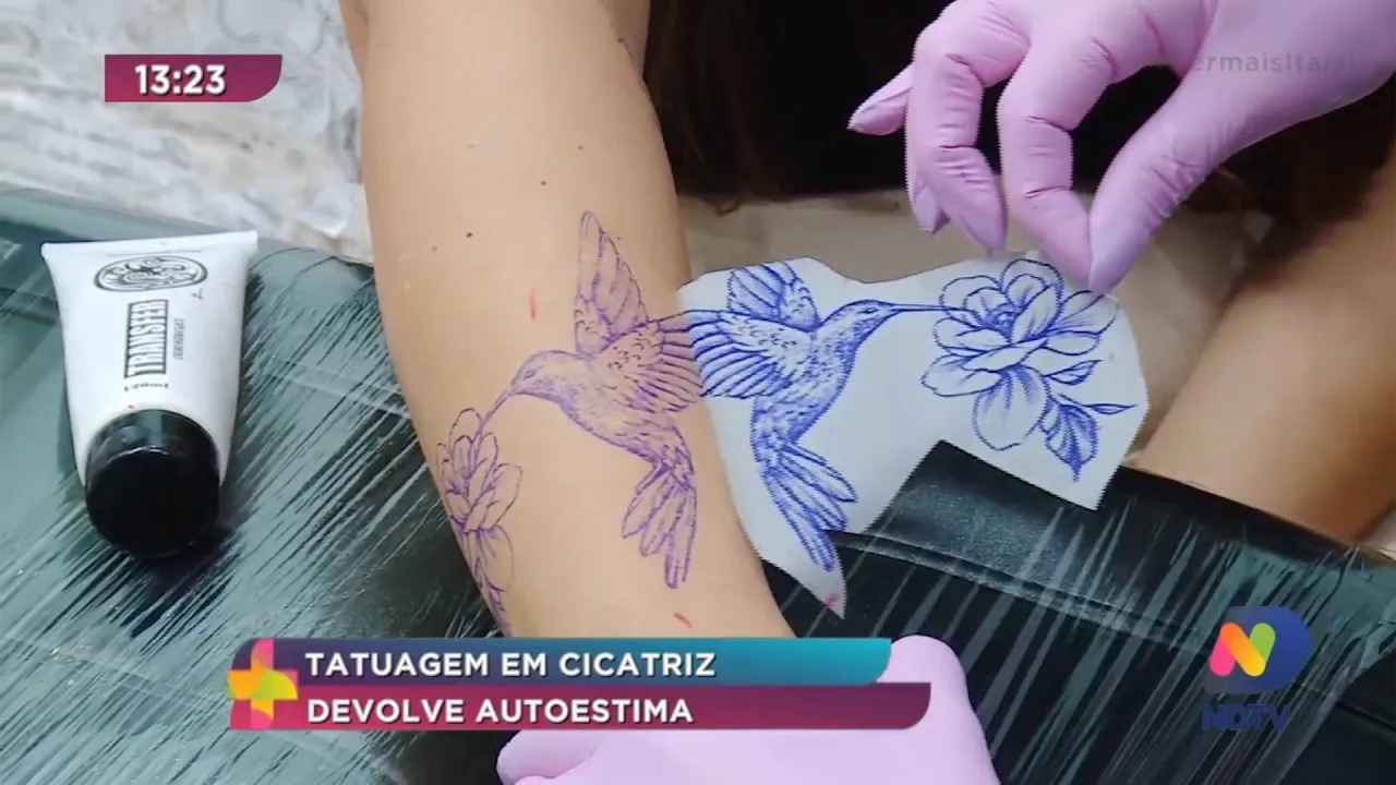 Tatuagem em cicatriz devolve autoestima