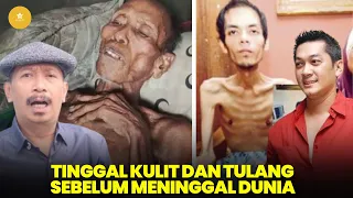 miris tubuh 8 artis ini hanya tinggal kulit dan tulang sebelum meninggal dunia