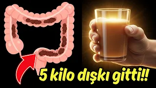 SADECE 3 MALZEME VE BAĞIRSAKLARINIZ TERTEMİZ OLACAK! TÜM HASTALIKLAR KABIZLIKTAN OLUYOR!