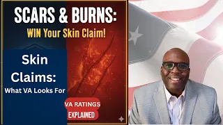 VA Skin Conditions Explained Scars Burns Disfigurement CFR 4 118 30 Claims in 30 Days