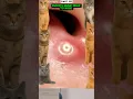Lagu Ever Noticed This Bump Near Your Nose? Watch Closely!” #shortsfeed #shorts
