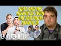 Doctors Help Nate Look More Identical to His Identical Twin Botched By Nature Botched E