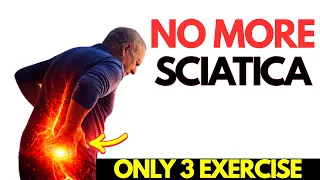Stop Stretching Sciatica After 50 These 3 Exercises Stops Sciatica Pain