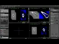ITK-SNAP Basics Tutorial