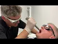 How Laser Snoring Treatment Works Nightlase Laser Snoring Treatment - Azure Medical