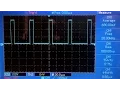 STM32 Timer Pulse Width Measurement with Timer Input Capture Mode