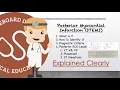 Posterior Myocardial Infarction Basics - Diagnosis ECG Leads V7 V8 V9 Clinical Medicine
