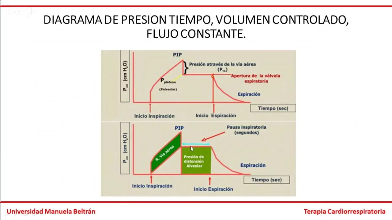 VIDEO CLASE MONITOREO GRAFICO VENTILATORIO