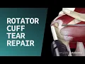 Rotator Cuff Tear Repair