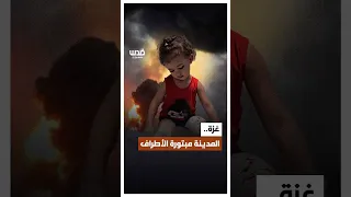 حرب الإبادة بغزة تحو لت أطراف الفلسطينيين إلى ثمن إضافي للنجاة قذائف لا تفر ق بين طفل وشيخ وامرأة 