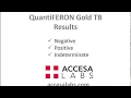TB Blood Test QuantiFERON Gold TB Blood Test Results Overview