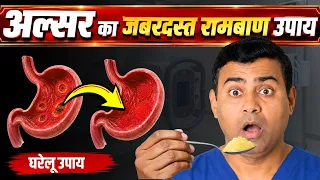 Ulcer का जबरदस्त रामबाण उपाय | बिना ऑपरेशन अल्सर से राहत कैसे पाएं?