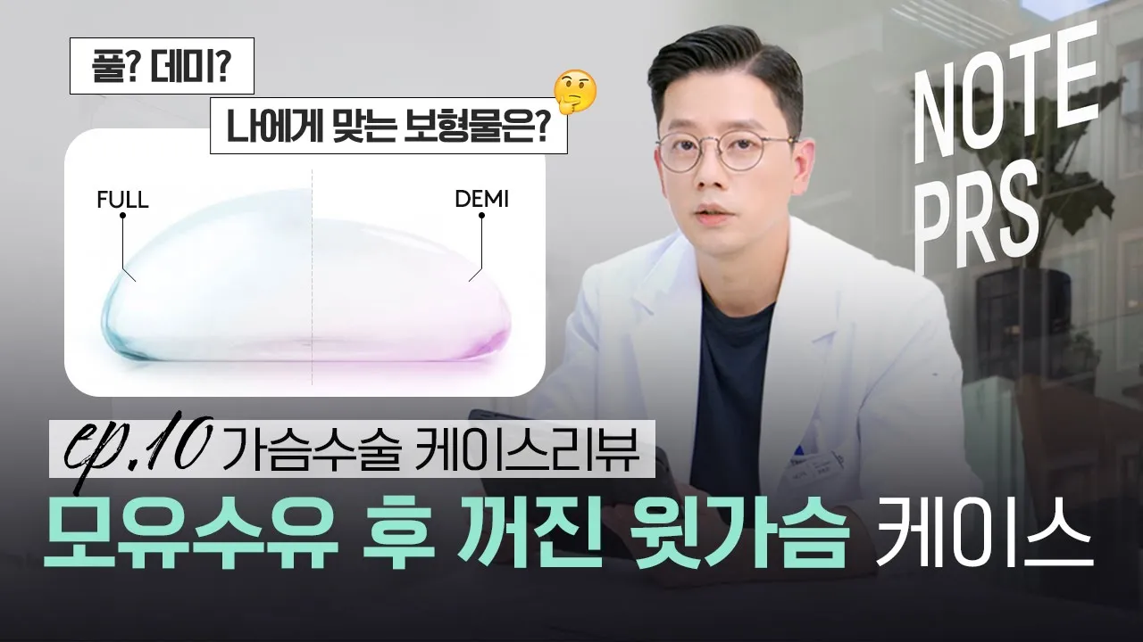 [가슴리뷰] 모유수유 후 l 윗가슴이 꺼진 케이스 l 모티바