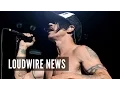 Red Hot Chili Peppers Anthony Kiedis Rushed to Hospital