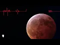 Pearl Jam - Superblood Wolfmoon
