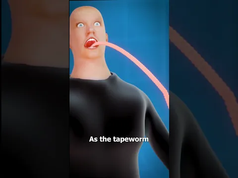 Download MP3 What Is A Tapeworm? 😨