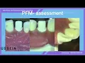 pfm assessment