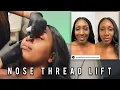 PDO Nose Lift on wide nose LIVE
