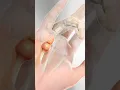Trigger Finger 3D Animation