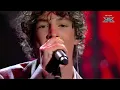 Mad-Dog | “Club Foot” | Live Performance 1 | X Factor 2026