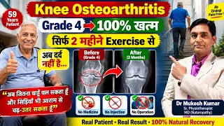 घुटनों का दर्द 100% ठीक हो गया । Knee Osteoarthritis Grade4 100% cured #ghutnekadard #Knepain