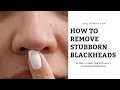 BLACKHEAD FREE IN TWO WEEKS FEATURING PHILOSOPHY S PORE EXTRACTOR MASK