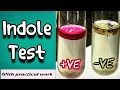 Indole test - Microbiology Microbial Biochemical test