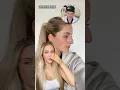 Incredible Nose Job Transformation - Surgeon Reacts
